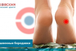 Лазерное удаление подошвенных бородавок