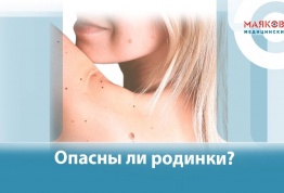 Опасны ли родинки