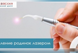 Родинки (невус)