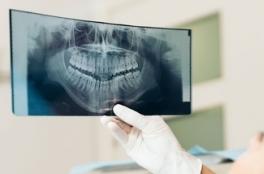 КТ челюсти и ИИ Diagnocat в подарок