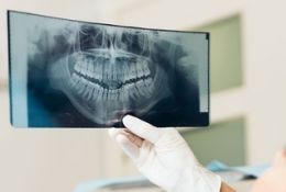 КТ челюсти и ИИ Diagnocat в подарок