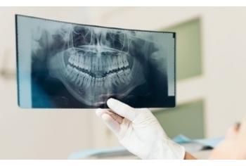 КТ челюсти и ИИ Diagnocat в подарок