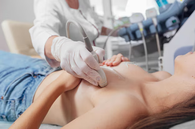 УЗИ молочных желез в Кирове